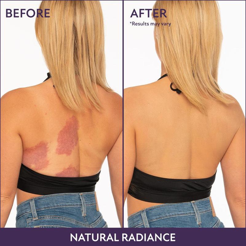 Elystria Beauty Body Coverage Perfector