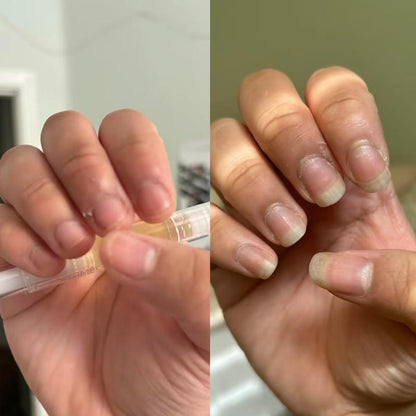 Organic Nail Growth Oil