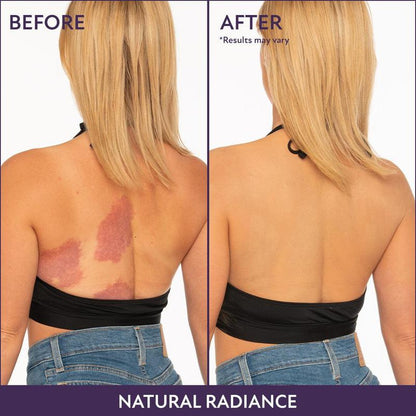 Elystria Beauty Body Coverage Perfector